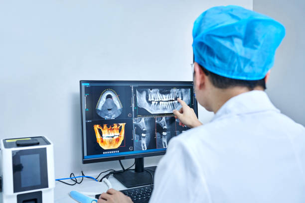 Best Emergency Wisdom Teeth Removal in Hawthorne, CA
