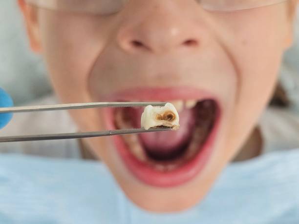 Best Emergency Gum Treatment in Hawthorne, CA